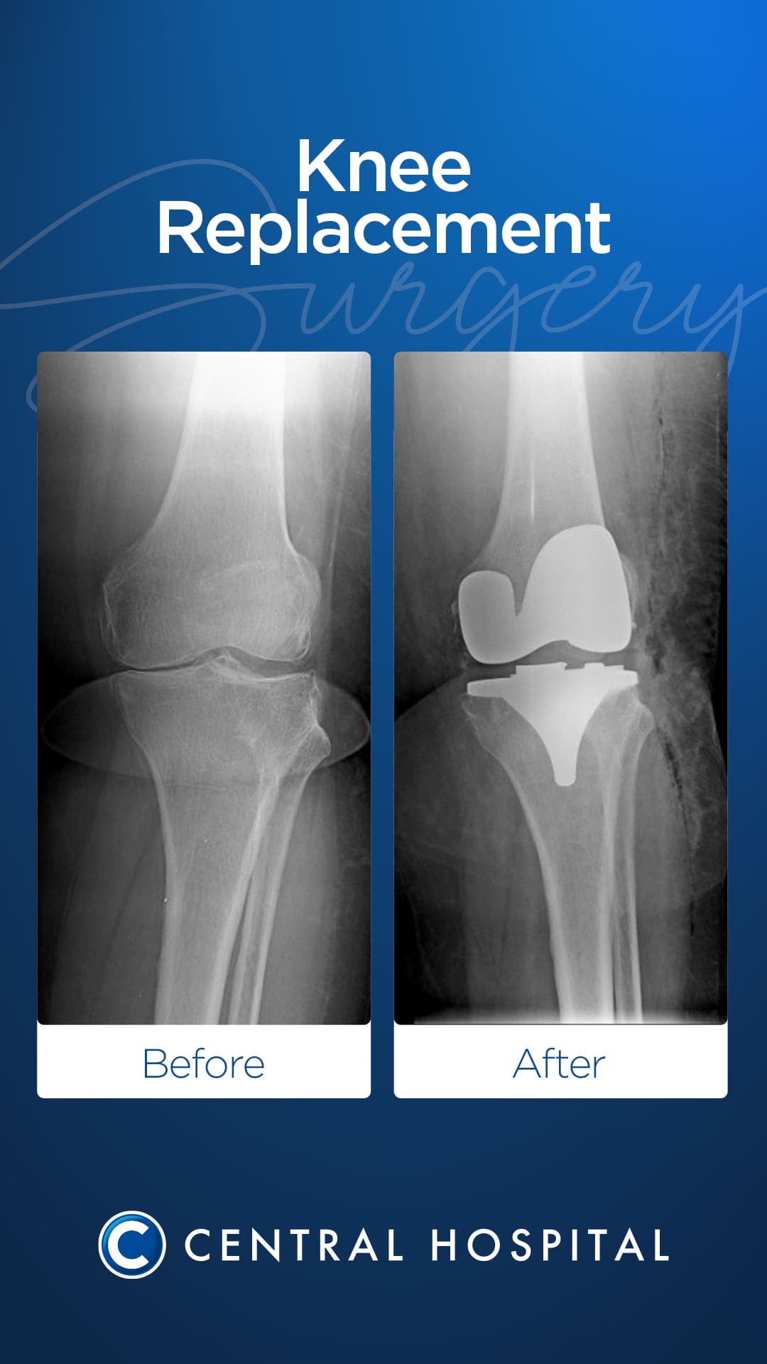Diz & Kalça Protezi 2