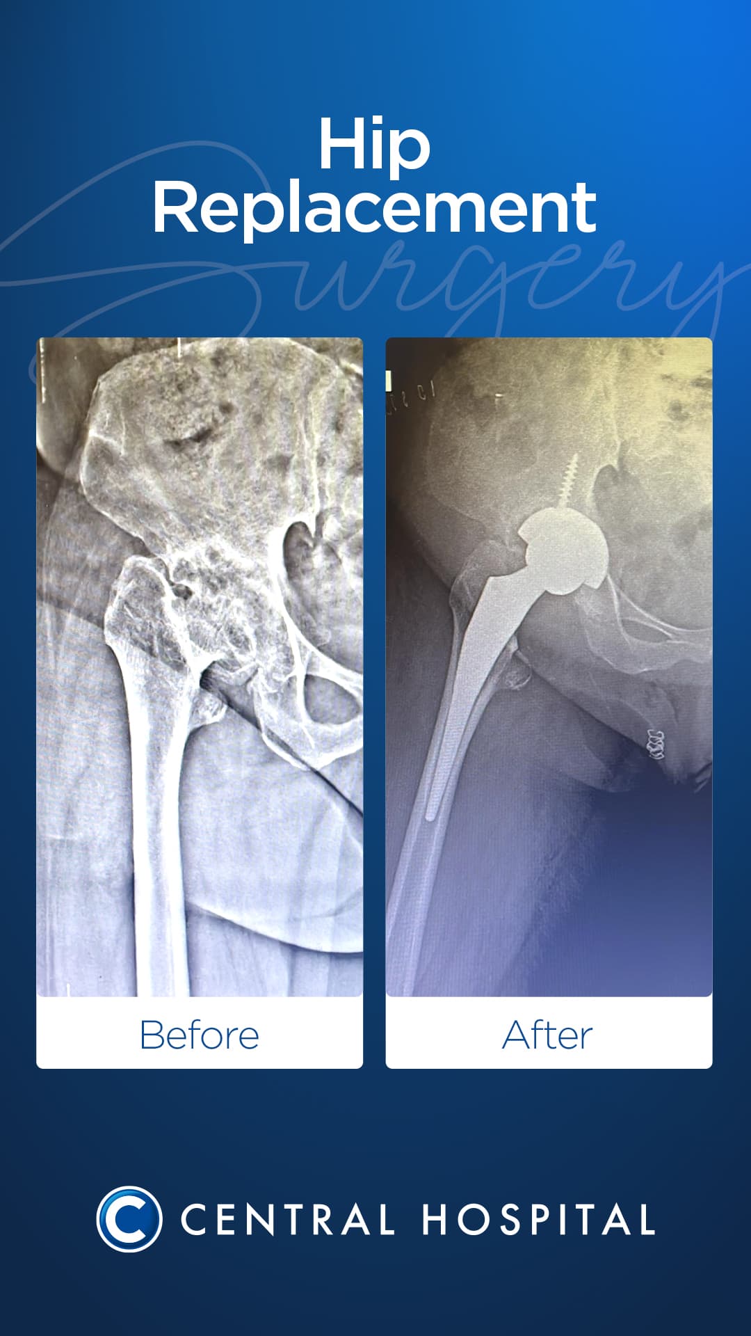 Diz & Kalça Protezi 3