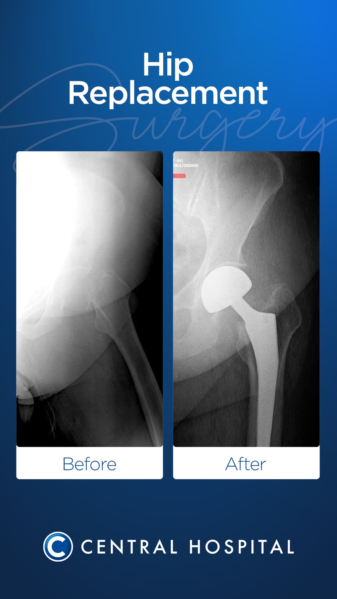 Diz & Kalça Protezi 4