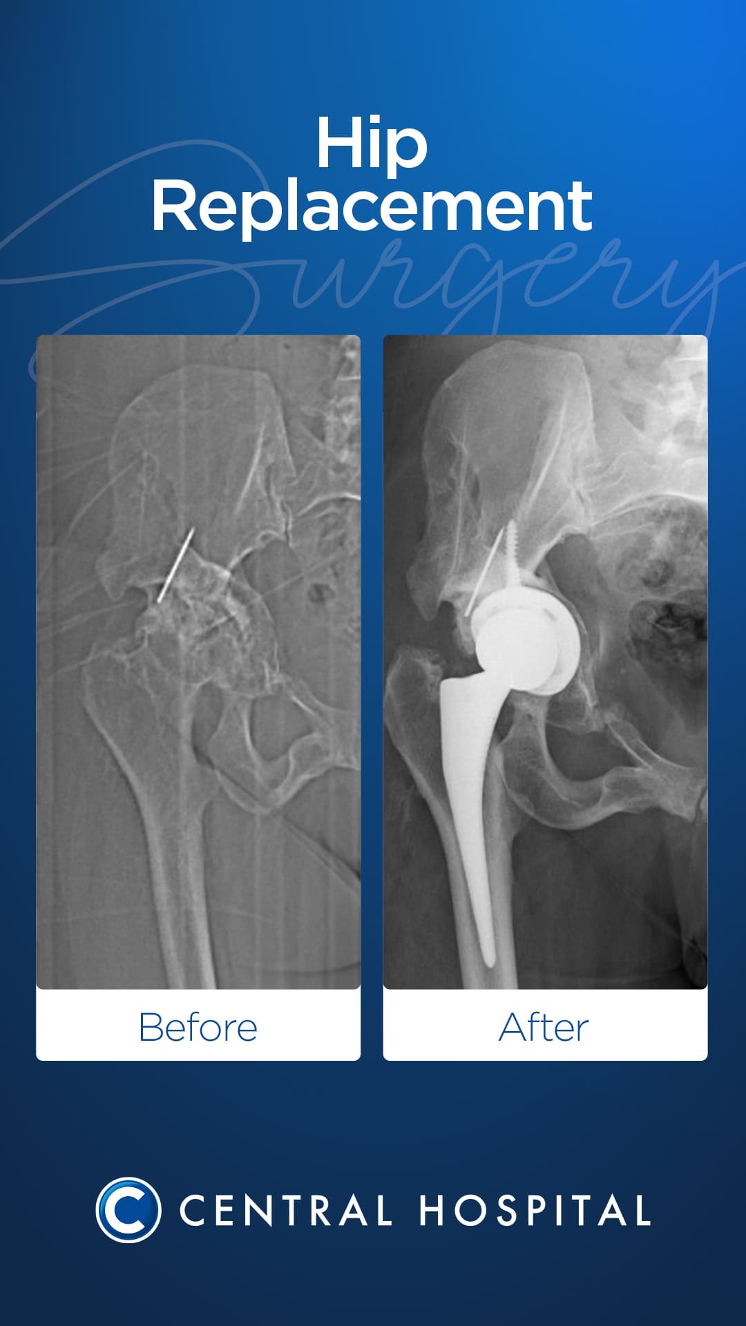 Diz & Kalça Protezi 5